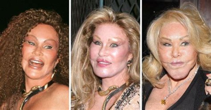 Catwoman Jocelyn Wildenstein's Journey Of Transformation And Self-Expression