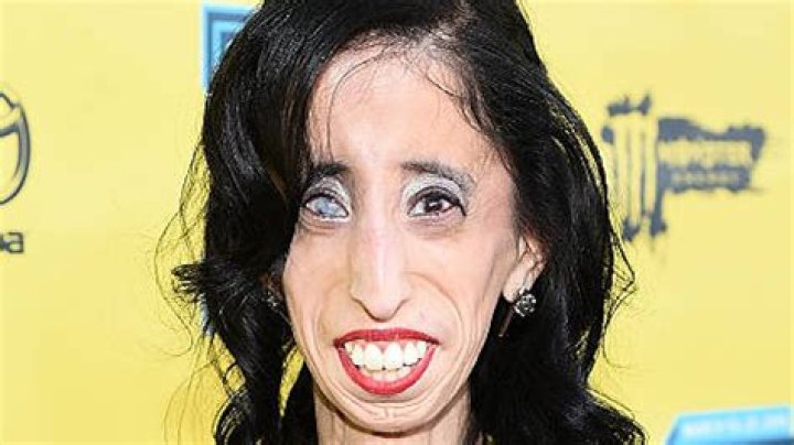 Exploring The Controversial "Ugliest Face In The World Record"